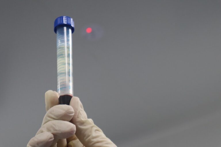 A blood test vial being held up in a clinical lab, representing ApoB optimal range testing for cardiovascular longevity