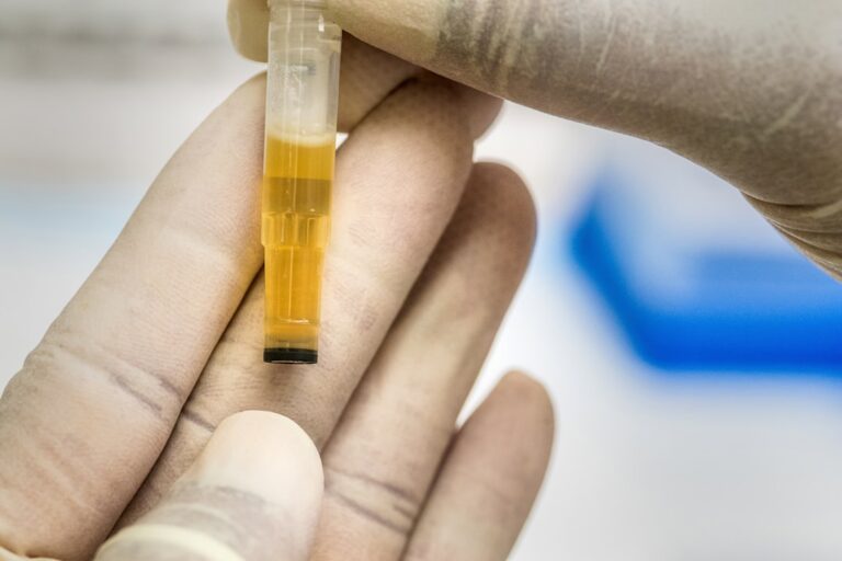 Person checking fasting glucose with a finger-prick blood test — the fasting glucose optimal range chart by age helps interpret your number